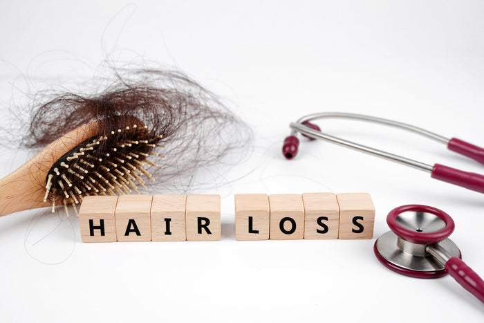 wooden hairbrush filled with shed hair, a stethoscope, and wooden blocks spelling hair loss